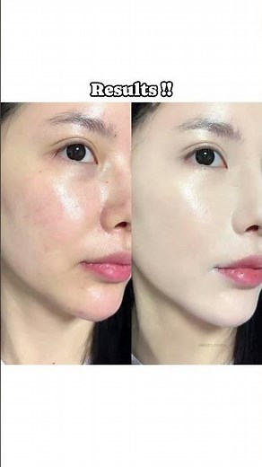 How to get Korean glass skin at home ✨#skincare #clearskin #glassskin #shorts #glowup #fypシ