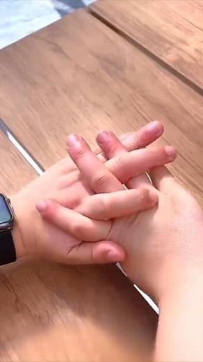 Isa sa mga pinaka-epektibong tool para sa hand rehabilitation! 💪 Ang device na ‘to ay tumutulong para ma-stretch at mapalakas ang mga daliri — perfect para sa mga stroke survivor na gustong ibalik ang grip control at flexibility. 🎯 Tip: Gamitin ito ng 5–10 minutes per session, 2–3 beses sa isang araw. Dahan-dahan lang ang galaw at iwasan ang sobrang stretch para hindi ma-strain ang kamay. Comment mo ng “Gusto ko nito!” kung gusto mong isama kita sa next giveaway ng rehab tools. 🙌 #Pagbangon #