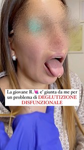 2.8M views · 1.6K reactions | ❤️La giovane R. è giunta presso il mio...