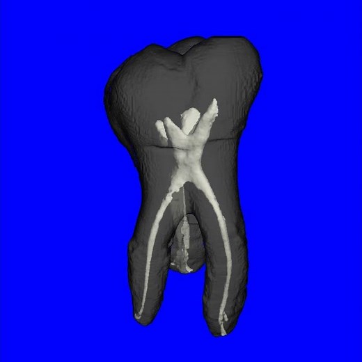 MicroCT of tooth
