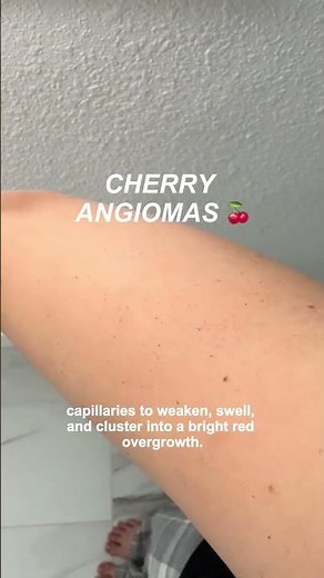 Stop ignoring these red dots!