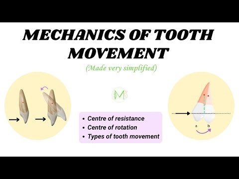 Mechanics of tooth movement | Orthodontics | Medinare