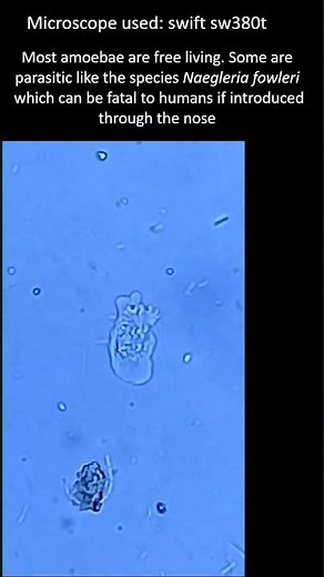 What do Amoebae feed on? Amoeba under the microscope. #microscopy