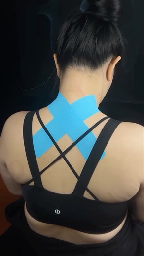 Spidertech Kinesiology Tape | Taping For Tech Neck. Comment “Tape” Below To Unlock Our Masterclass. #kinesiology #kinesiotape #techneck #neckpain | Instagram