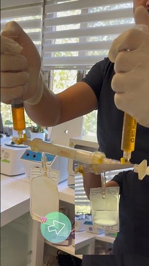 A2M enjeksiyonu, kireçlenme ve tendon yaralanmalarında iyileştirici etkiye sahiptir! #utkuerdemözer