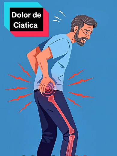 ¿Por qué da dolor de Ciática? Explicación completa
