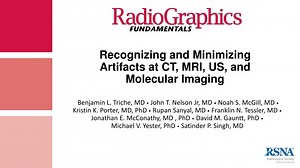 Recognizing and Minimizing Artifacts at CT, MRI, US, and Molecular Imaging - SlideServe