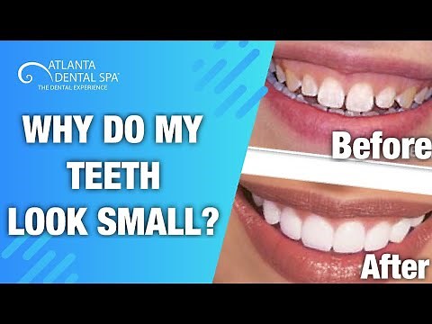 How to FIX small looking teeth!