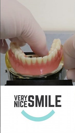How to remove a snap in denture