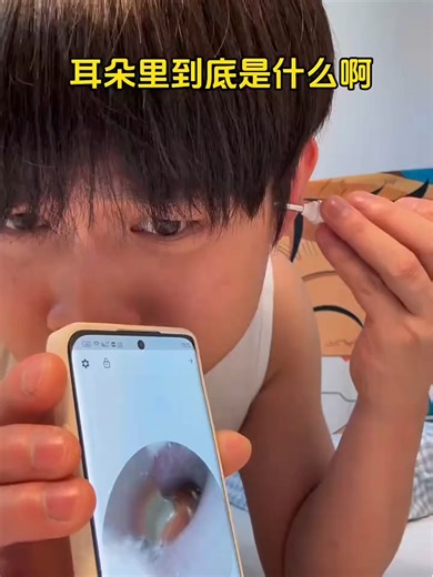 Visual Ear Spoon 453 - Ear Cleaning Tool