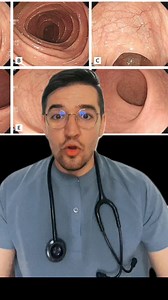 110K views · 1.4K reactions | Pentru ca mulți dintre voi sunteți...