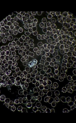 White blood cell under microscope #science