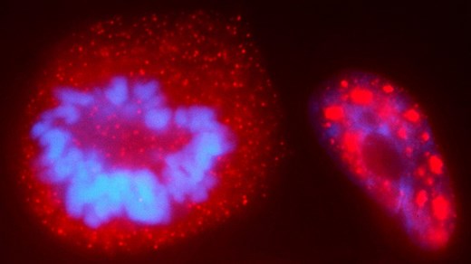 Princeton researchers bend DNA strands with light to probe the genome