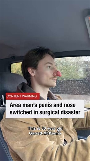 This guy @canteen_boi made a skit where he went under surgery and the surgeons literally swapped his penis with his nose.Now he pees from his face, smells from his balls, and sneezes better than sex.He's going super viral on X with over 10m views across various users in just 5 hours.I've already messaged him on Instagram and I'm currently waiting for his Solana address so I can redirect 100% of the fees to him.