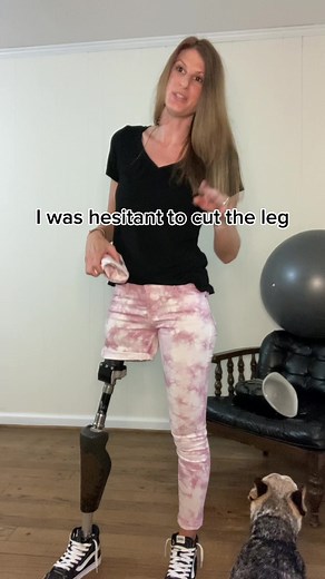 Amputee Fashion: Showing Off My OPRA Implant System