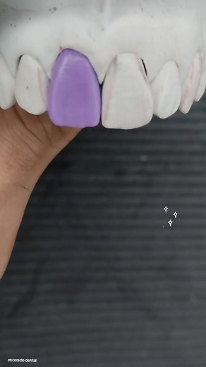 Encerado Dental: Paso a Paso del Incisivo Central Superior
