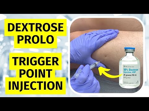 Prolotherapy Trigger Point Injection for Myofascial Pain Syndrome