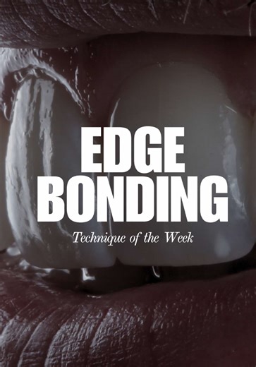 Edge bonding shouldn’t feel like a countdown to failure. If you’ve ever lengthened 8 and 9 and thought, “This is probably going to chip,” you’re not alone — and it’s not because edge bonding doesn’t work. 👉🏼It’s because most of it is done too thin. Composite doesn’t get a little stronger as it gets thicker. It gets exponentially stronger. In this case, we’re building real thickness, controlling the profile, layering color intentionally, and sharing occlusion so the edges actually function — no