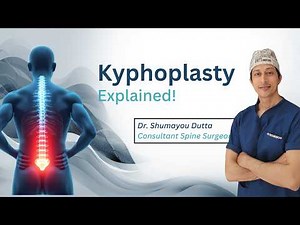 Kyphoplasty for Osteoporotic Vertebral Fractures | Is It Safe? How It Works & Recovery.