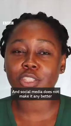 “Bleaching was an addiction. I could not stop.” Ellen talks to #TheComb about why she ended up using skin bleaching products. https://bbc.in/3buikQP | BBC World Service