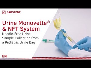 Needle-free collection of urine samples from a pediatric bag with SARSTEDT’s Urine Monovette®