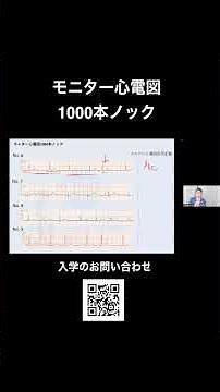 【米山先生のモニター心電図1000本ノック】 モニター心電図で期外収縮を見抜けるか？✨ #Shorts #心電図 #右脚ブロック