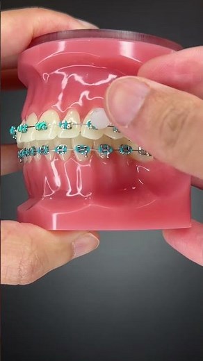 How to use Ortho Wax