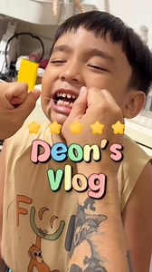 Officially part of the toothless club! 😬💙 #DeonCarlAngelo | Deon Carl Angelo Maglanoc