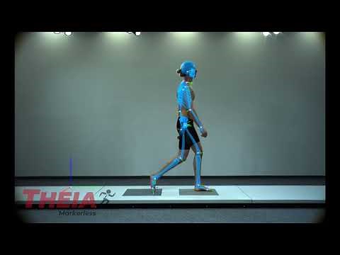 3D markerless tracking: Gait Analysis // CONTEMPLAS MULTI CAMERA SYSTEM®