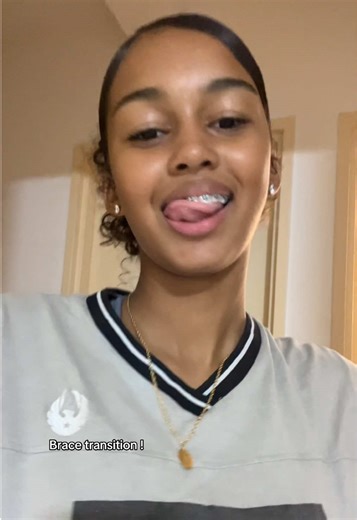 #CapCut #fyp #wasian #blasian #trending | Braces Transition