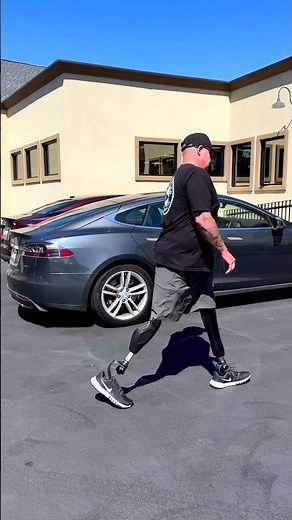 Blateral AK/BK Amputee Walking on Prosthetic Legs | Chris
