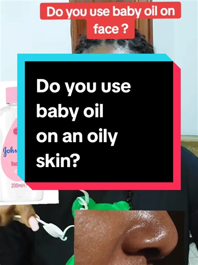 Does Baby Oil Favor Acne-Prone Skin? Clear Guide