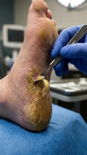 Relaxing Foot Cleaning ASMR | Deep Heel Care