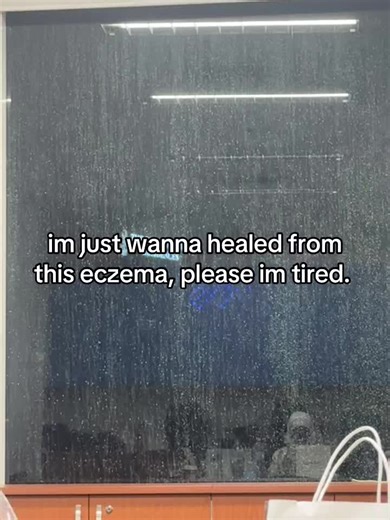 im crying everytime i struggle with my eczema, seeing all the dry flakes in my bed 😔#EczemaAwareness #EczemaRelief #HealthySkin #eczema #eczemaflareup #fyp #mentalhealth #fypage #SkinHealth #eczemawarrior #eczemaawareness #SkinHealth #aiteam