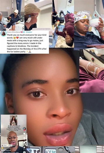 Dear @Grace Mondlana 🎀 What happened to you was just a shock for your fans ,we have never expected something like this happening to you but as long as you have shown us on social media we are wishing you to be alright and good health looking forward 😭😭 I really love you for being strong for yourself and your family. It’s not easy to go through pains but as your fans we love you 😍 Our Grace will be alright for us , as long as she is strong and health wise she will be fine. Don’t mind the nega