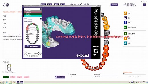 牙科CAD软件ExoCad DentalDB CAM CAD 2011-2015版演示教程