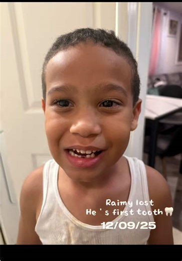 Cant believe my first born is already loosing he’s teeth 🦷😩, he is growing up to fast. #toothfairy #fyp #boymom #bigboy #toothless