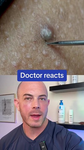 Derm reacts to infected ingrown hair! #dermreacts #ingrownhair | Dr. Dustin Portela, Dermatologist