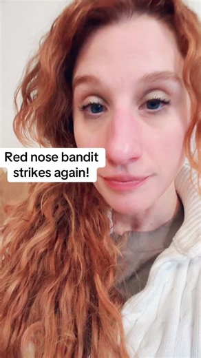 Mackinac Redhead on Instagram: "The red nose bandit strikes again. Why???? #rednose #autoimmunedisease #chronicillness"