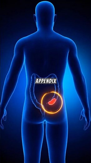 What Happens If Your Appendix Bursts?