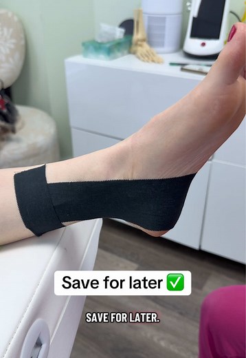Taping for Collapsed Arch & Inner Ankle Pain | PTTD Support