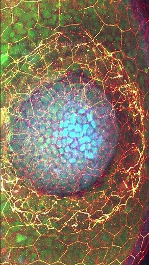 Have you ever seen a zebrafish eye?