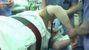 Arthroscopic Treatment of the Arthritic Elbow