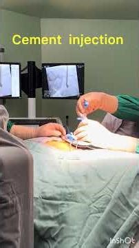 Kyphoplasty procedure:tips and tricks