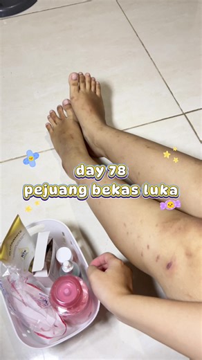 Essential Body Care Routine with Bio Oil