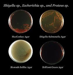 What is a culture media for bacteria? [2025] | QAQooking.wiki