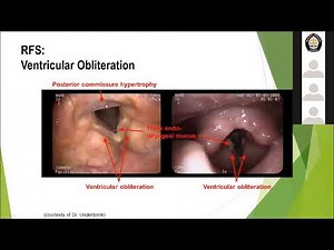 Laryngopharyngeal Reflux (LPR)