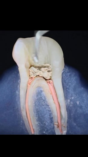 97K views · 106 reactions | Endo process!! #highlights2025...