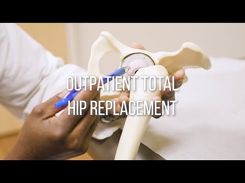 Outpatient Hip Replacement Surgery