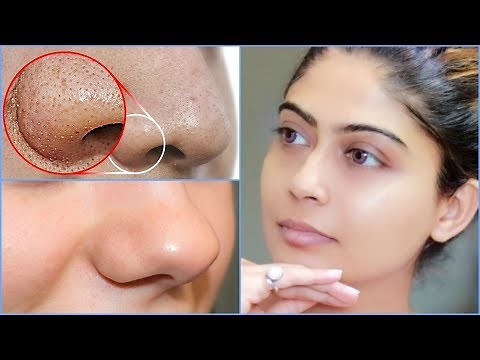 How To do Facial Cleanup At Home | Rinkal Soni